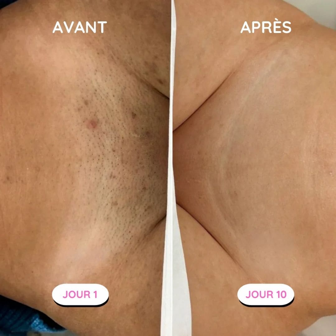 Rasoir électrique féminin - Épilation douce et sécurisée