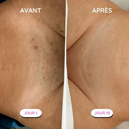 Rasoir électrique féminin - Épilation douce et sécurisée