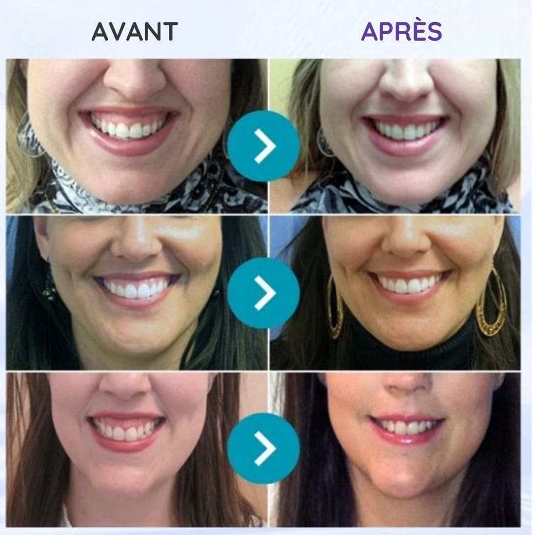 Dentifrice Blanchissant 3-en-1