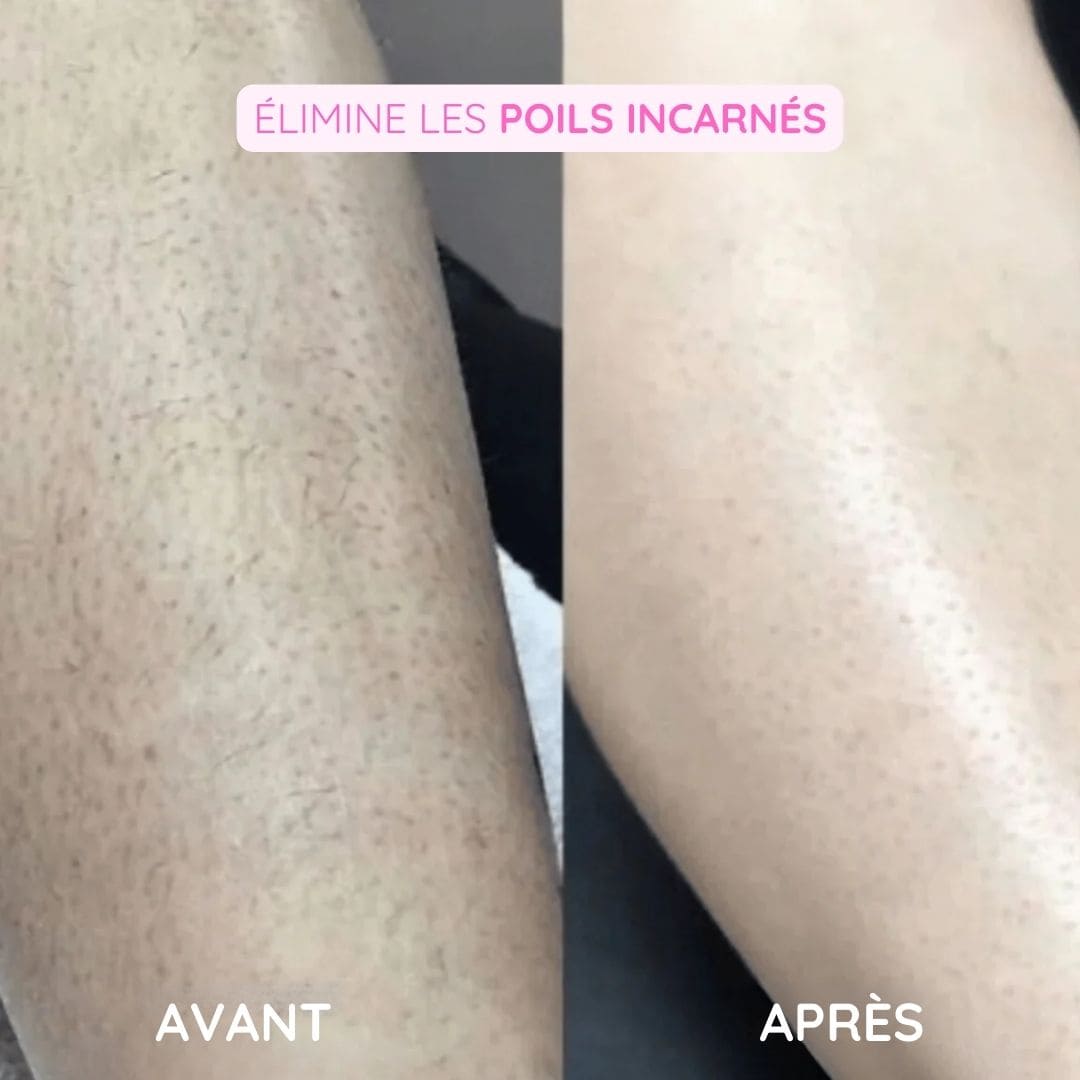 Rasoir électrique féminin - Épilation douce et sécurisée