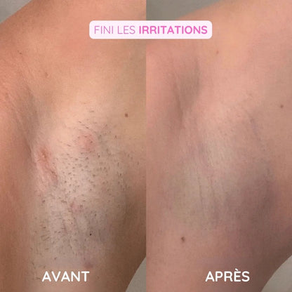 Rasoir électrique féminin - Épilation douce et sécurisée