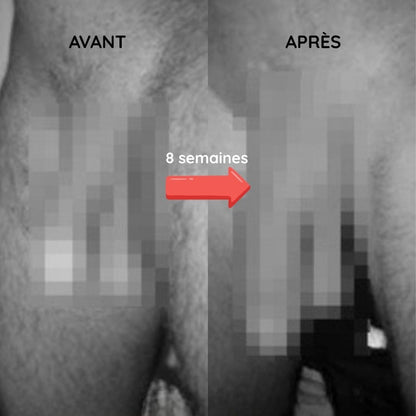 Anneau vibrant électrique de stimulation masculine