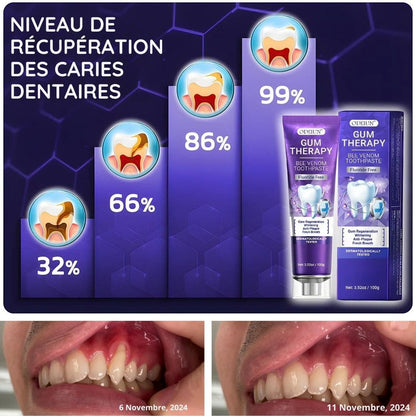 Dentifrice Blanchissant 3-en-1