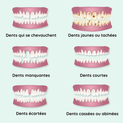 Gouttières amovibles d’alignement dentaire - Dentition parfaite