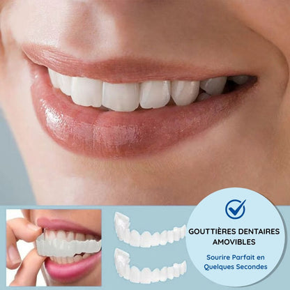 Gouttières amovibles d’alignement dentaire - Dentition parfaite