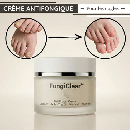 Crème antifongique pour les ongles