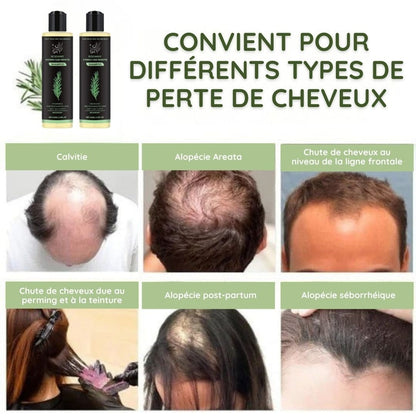 Shampooing au Romarin & Kératine Hydrolysée – Cheveux Épais, Forts & Brillants
