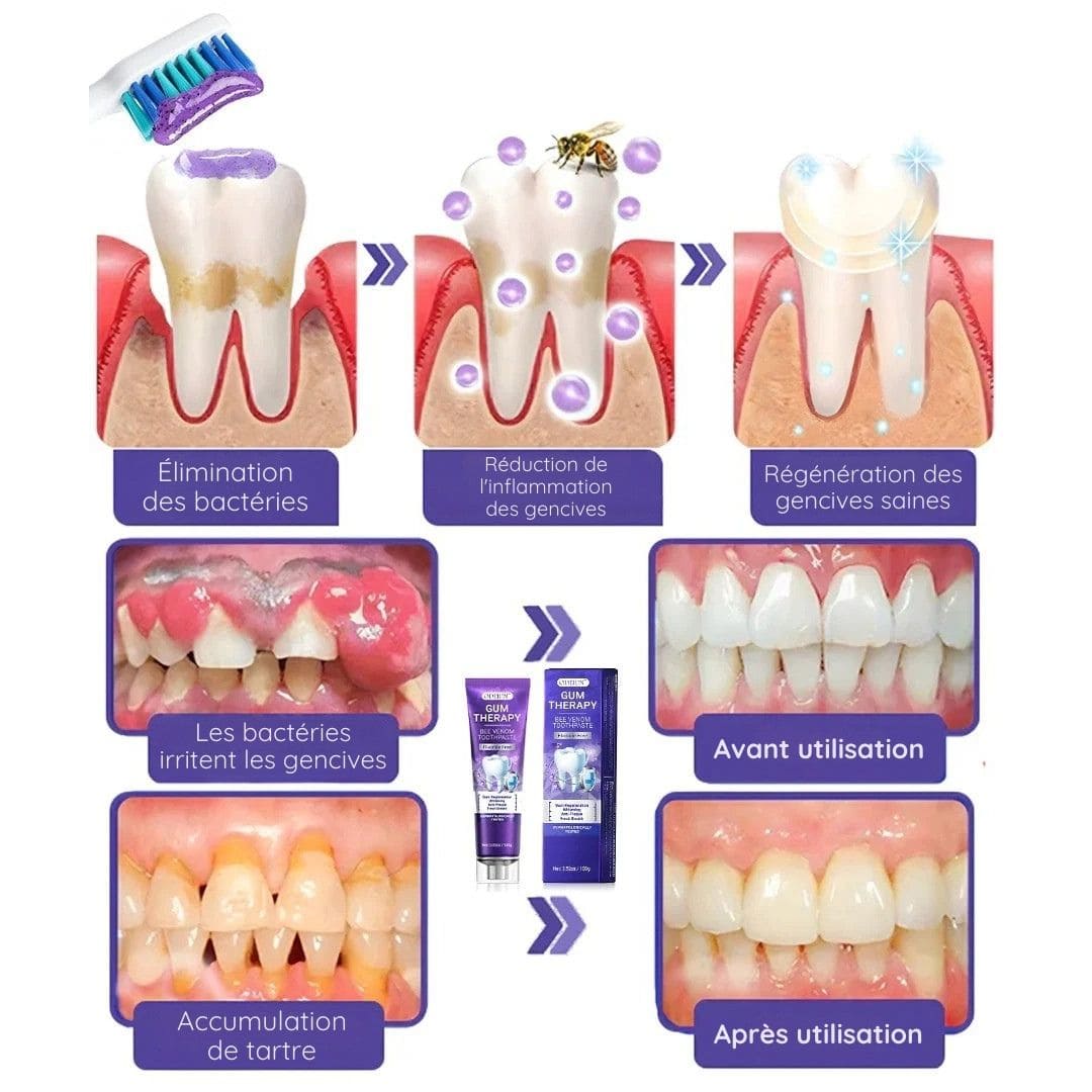 Dentifrice Blanchissant 3-en-1
