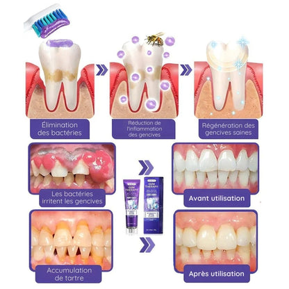 Dentifrice Blanchissant 3-en-1