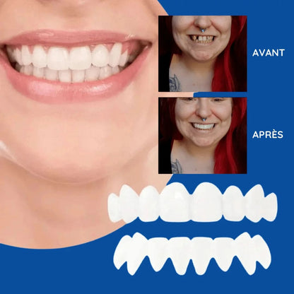 Gouttières amovibles d’alignement dentaire - Dentition parfaite